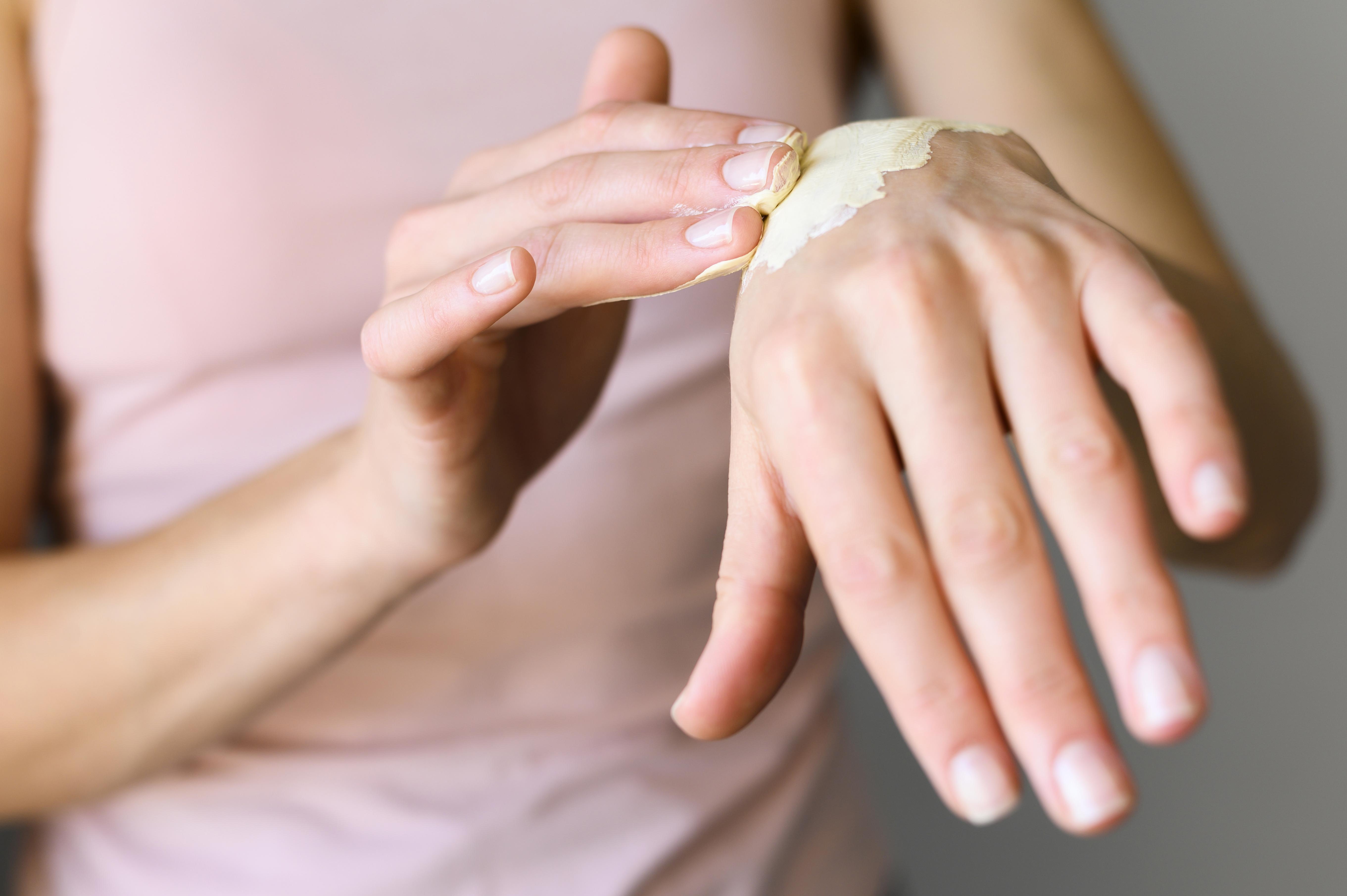 Burn Blister: Should You Pop It or Not?