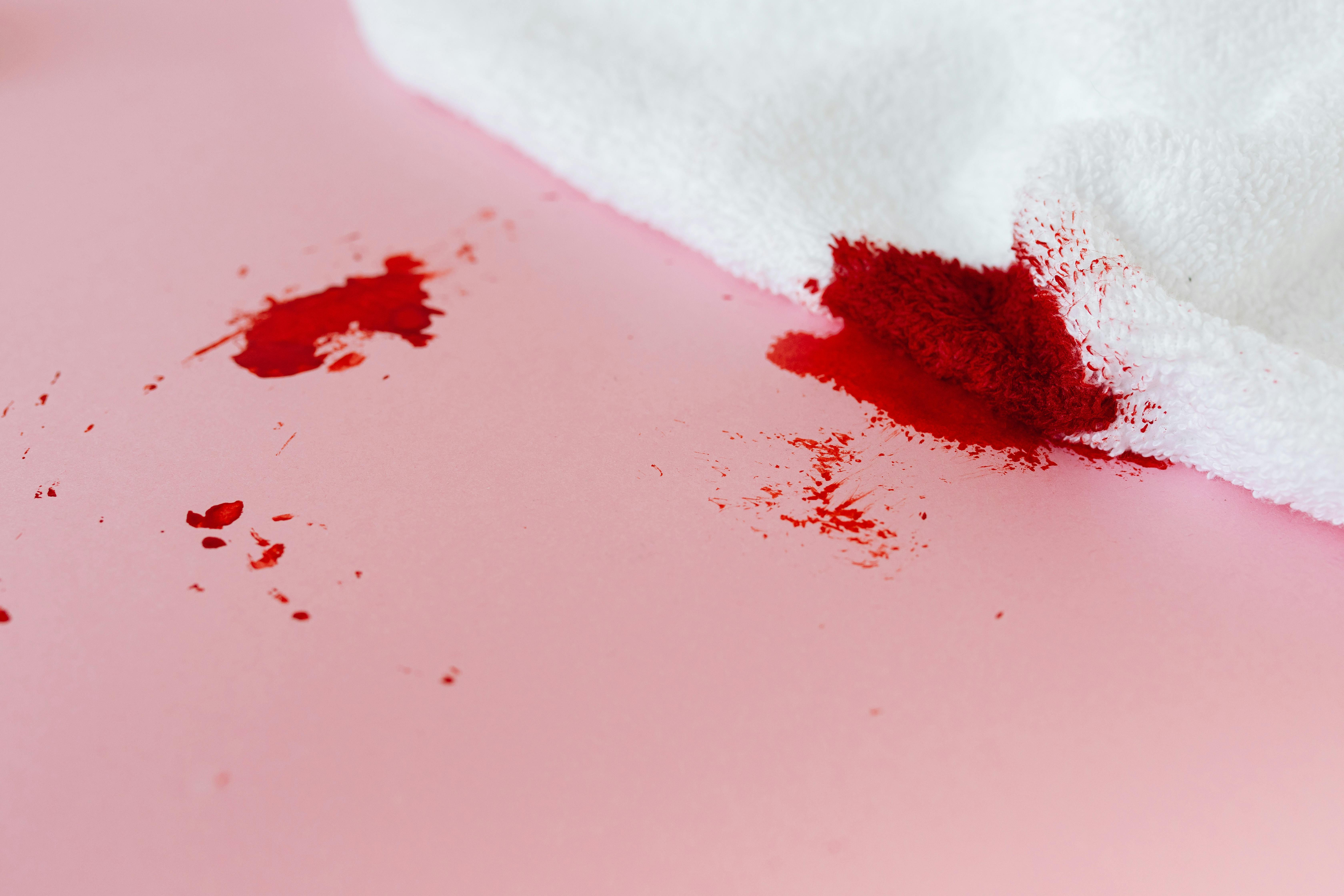 Nosebleed Won't Stop? Here's What to Do